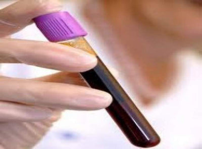 COULD A BLOOD TEST DETECT AUTISM?